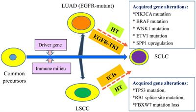 Histological transformation into SCLC: An important resistance mechanism of NSCLC upon immunotherapy